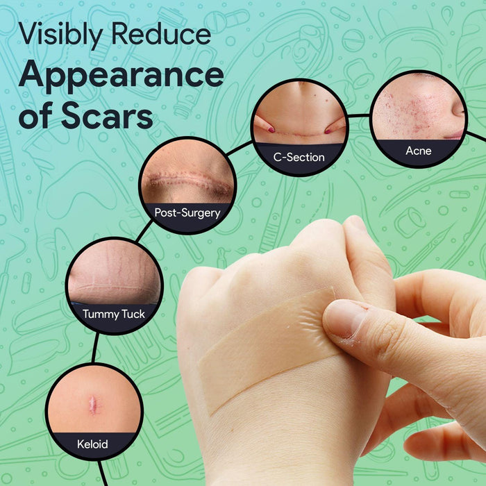Silicone Tape For Scar Removal - 1 Roll - ProHeal-Products