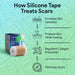 Silicone Tape For Scar Removal - 1 Roll - ProHeal-Products